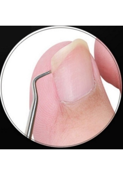 Adet Parmak Ayak Tırnak Makası Çift Taraflı Temizleme Kancası Batık Ayak Tırnaklarını Düzeltici Bakım Pedikür Manikür Araçları (Yurt Dışından) fırsatları