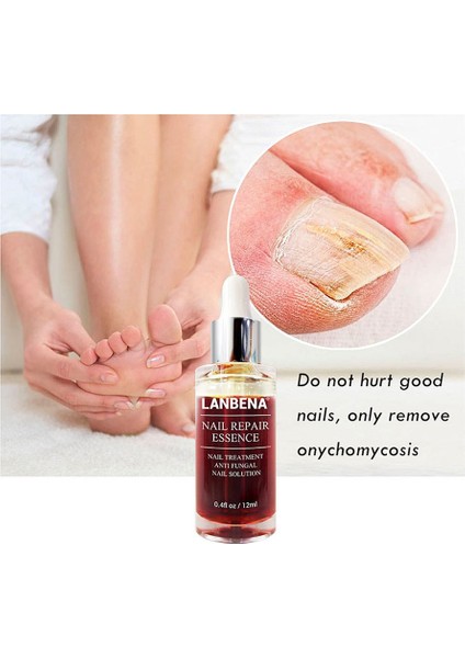 Ma Küçük Tırpanlı Tırnak Onarıcı Esans 12ML Salisilik Yumuşatıcı Bakım (Yurt Dışından) indirimleri