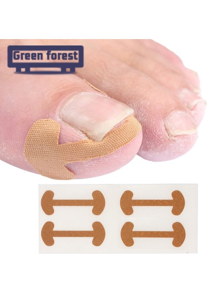 Yeşil Orman Pedikür Çıkartmaları Rahat Batık Ayak Tırnağı Düzeltme Çıkartması (Yurt Dışından) fırsatları