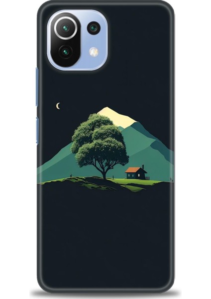 Xiaomi Mi 11 Lite Uyumlu Kılıf Hd Baskılı Kılıf - 564