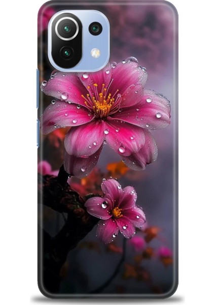 Xiaomi Mi 11 Lite Uyumlu Kılıf Hd Baskılı Kılıf - 311