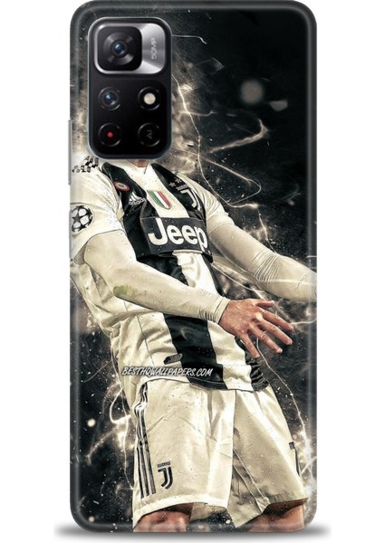 Xiaomi Redmi Note 11 / 11S Uyumlu Kılıf Hd Baskılı Kılıf - 454