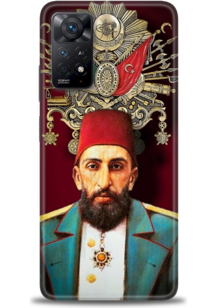Xiaomi Redmi Note 11 Pro Uyumlu Kılıf Hd Baskılı Kılıf - 1063