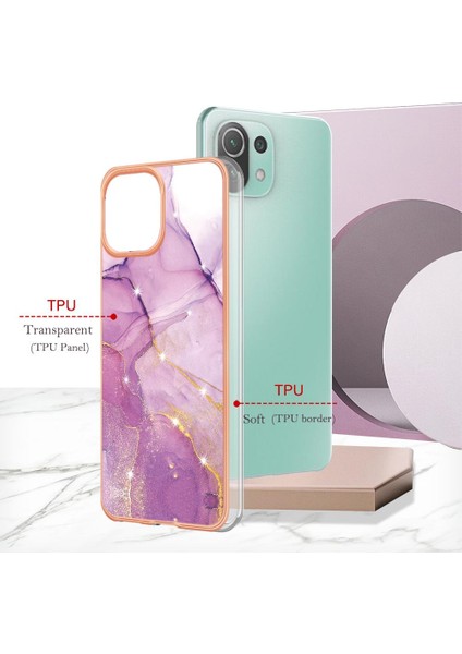 Xiaomi 11 Lite Için Kılıf (Yurt Dışından) modelleri