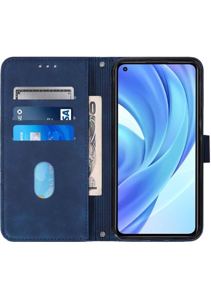 Xiaomi Mi 11 Lite 5g Için Kılıf (Yurt Dışından)