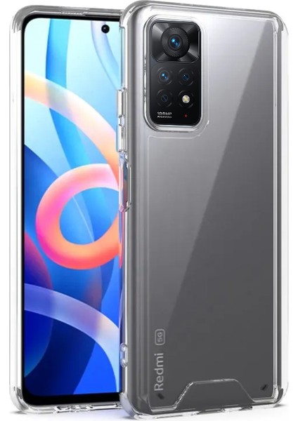 Xiaomi Redmi Note 11 4g Uyumlu Kılıf Zebana Hd Şeffaf Silikon Kılıf Şeffaf