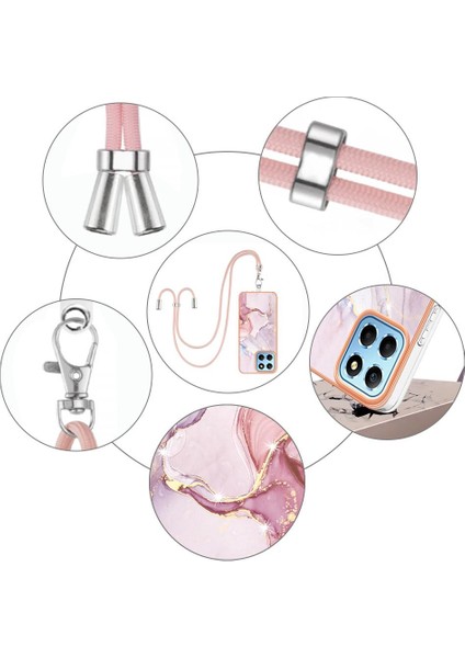 Onur X8 5g Tampon Crossbody Kordon Askısı Mermer Anti-Scratch Için Kılıf (Yurt Dışından)