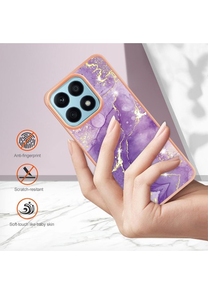 Onur X8A Için Durum (Yurt Dışından) fiyatları