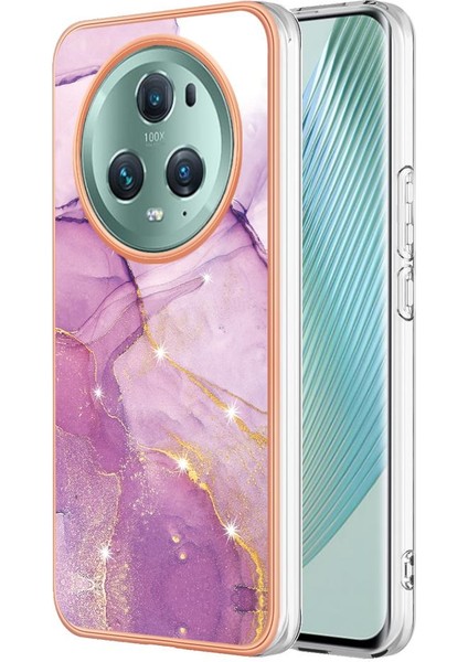 Onur Magic 5 Pro Için Durum (Yurt Dışından)