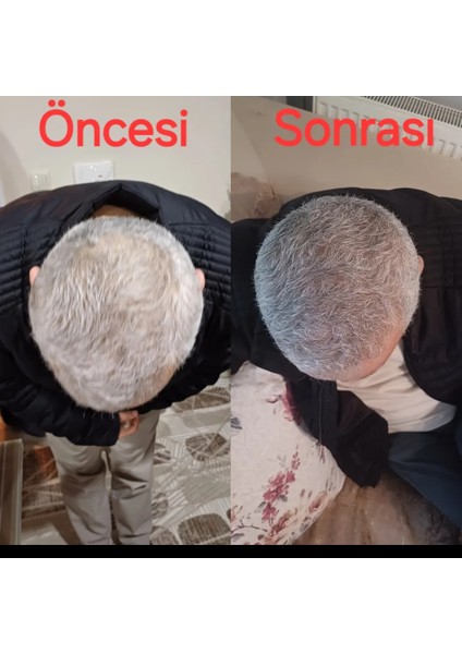 Karasarımsak Sabunu