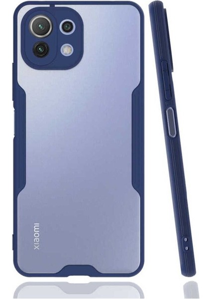 Xiaomi Mi 11 Lite Uyumlu Kılıf Parfe Kapak, Lacivert