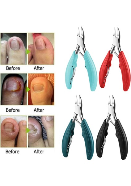 Роговой Слой Batık Tırnak Makası Ayak Tırnağı Makası Tırnak Eti Makası Tırnak Makası Kesici Paronişi Aracı Кусачки Для Ногтей (Yurt Dışından)