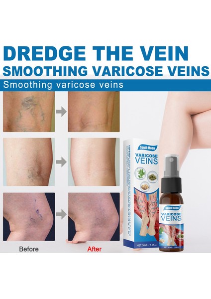 30 ml Rahat Varisli Damar Venöz Masaj Sprey Aktive Edici Sprey Pürüzsüz Bacak Kan Damarı Şişme Vücut Bakımını Rahatlatır (Yurt Dışından) fırsatları
