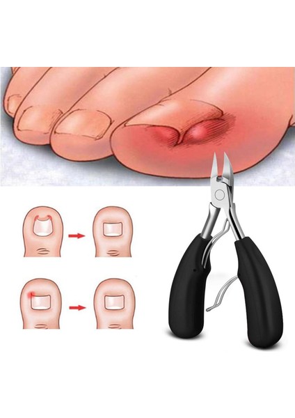 Paslanmaz Çelik Ayak Tırnak Makası Tırnak Eti Pensesi Manikür Pedikür Kesiciler Ölü Cilt Kir Sökücü Ayak Bakımı Kesim Ayak Tırnaklarını Pençe Cu (Yurt Dışından)