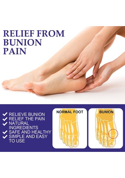 Adet Eklemler Bunyon Giderici Yama Güvenli Sağlıklı Anti Bunyon Yama Doğal Rahatsızlığı Rahatlatmak Vücut Tedavisi Için Dolaşımını Teşvik Edin (Yurt Dışından) fırsatları