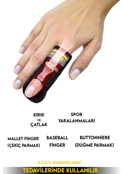 ® Phalango Fix Parmak Sabitleme Parmak Ateli STANDART BEDEN