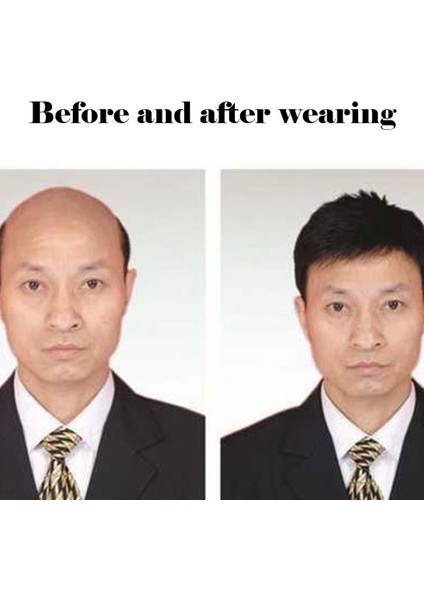 Peruk Erkek Kısa Saç Baş Üstü Yedek Blok Tam Saç Değiştirme - Siyah Brüt Inç Mekanizması 16*18 (Yurt Dışından) modelleri