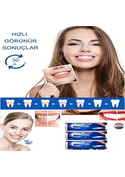 Diş Bandı 5 Min Go Diş Beyazlatma Bandı 3D White Professional Effects Diş Beyazlatma Bantları