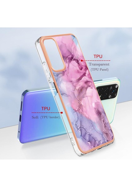 Xiaomi Redmi Not 11 4g Kılıf ile Uyumlu (Yurt Dışından)