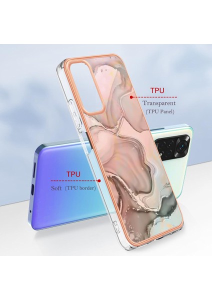Xiaomi Redmi Not 11 4g Kılıf ile Uyumlu (Yurt Dışından)