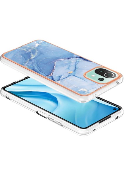 Xiaomi 11 Lite 5g Durumda ile Uyumlu (Yurt Dışından)