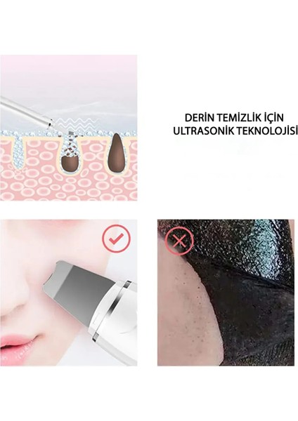 Ultrasonik Cilt Scrubber Derin Soyulma Kürek Yüz Gözenek Temizleyici Yüz Cilt Scrubber fırsatları