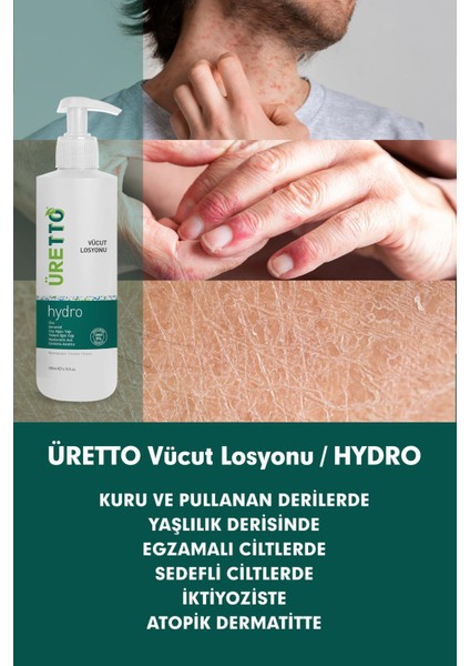 Uretto Hydro Vücut Losyonu 200 ml