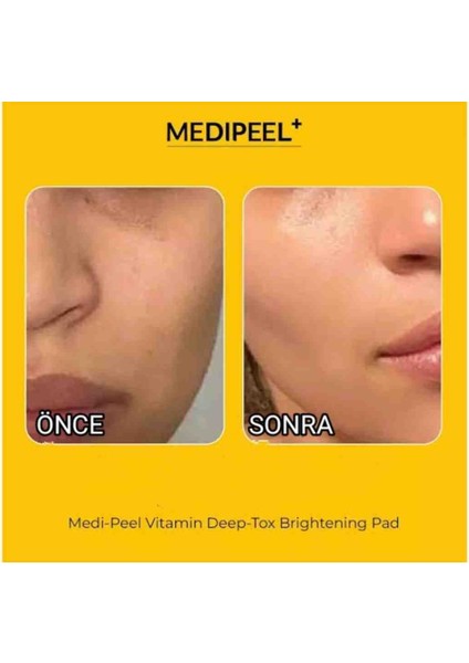 Medı-Peel Vegan Vitamin Deep-Tox Aydınlatıcı Ped 70'Li