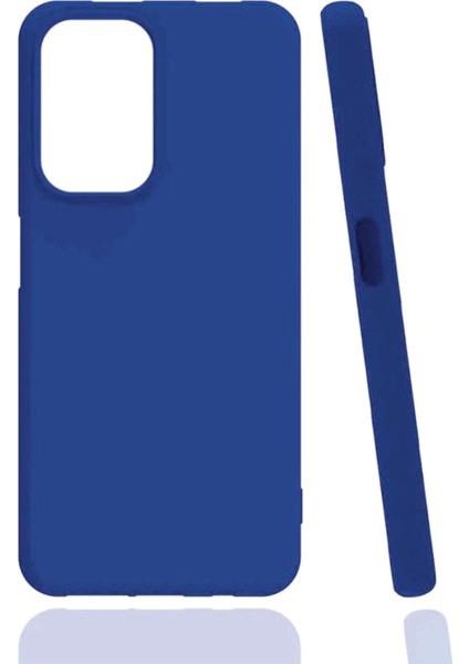 Vivo Y21S Uyumlu Kılıf Kamera Korumalı Silikon Zore Biye Arka Kapak