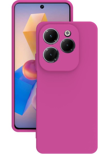 Infinix Hot 40I Uyumlu Kılıf Kamera Korumalı Silikon Zore Biye Arka Kapak