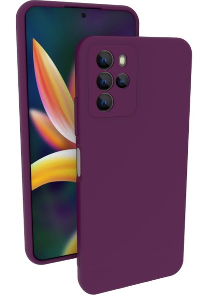 Omix X700 Uyumlu Kılıf Kamera Korumalı Silikon Zore Biye Arka Kapak