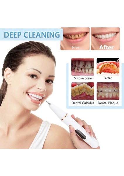 Şarjlı Ultrasonic Titreşimli Diş Taşı Tartar 6 Farklı Alet Diş Lekesi Temizleme 3 Modlu Led Ekranlı Işıklı Elektrosonik Temizleyici