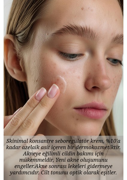 Azelaik Asit İçeren Akne Karşıtı + Sebum Azaltıcı + Aydınlatıcı Krem 50 ml fırsatları