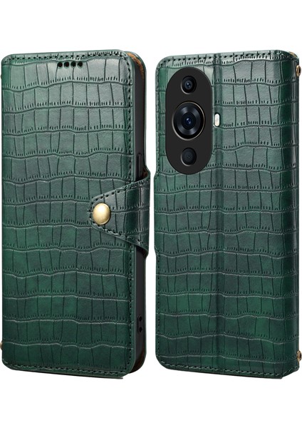 Huawei Nova 11 Pro / Nova 11 Ultra Cüzdan Timsah Dokulu Deri Kılıf (Yurt Dışından)