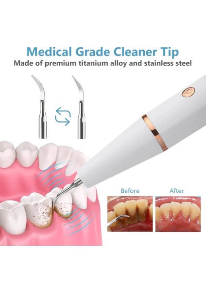 Şarjlı Ultrasonic Titreşi Mli Diş Taşı Tartar Diş Lekesi Temizleme 3 Modlu Led Ekranlı Işıklı Elektrosonik Temizleyici fırsatları