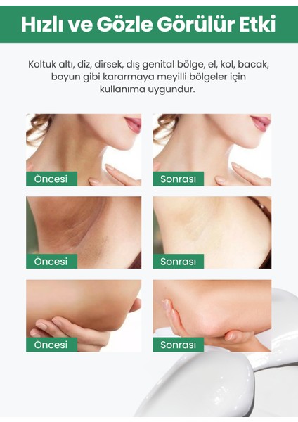 Vücut Beyazlatıcı Krem fırsatları