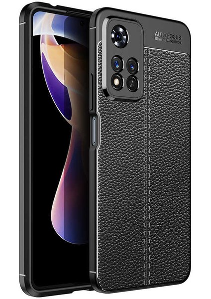 - Xiaomi Redmi Note 11 Pro Plus 5g Uyumlu Kılıf Deri Görünümlü Auto Focus Karbon Niss Silikon Kapak