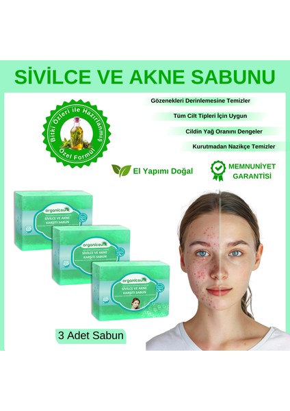 Doğal Akne Ve Sivilce Karşıtı Sabun 140 Gr X 3 Adet Tüm Cilt Tipleri Için Natural Sabun