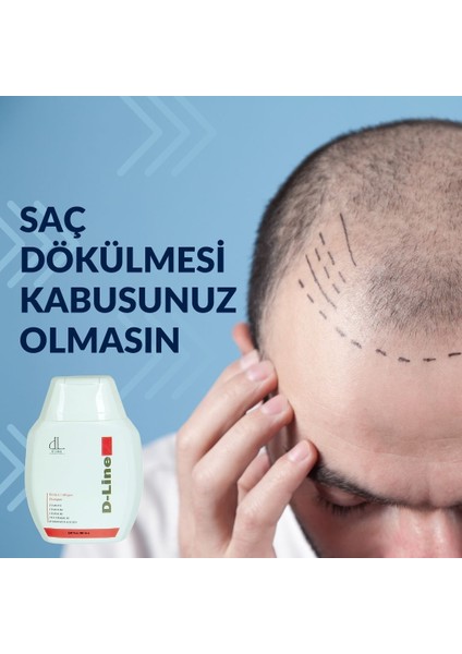 Şampuan,biotin&collagen, Saç Ekimi Sonrası Bakım, Parlak ve Güçlü Saçlar, Saç Kaybı 2'li paket