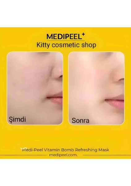 Medı-Peel Vitamin Bomb Refreshing Mask(Donukluklara Karşı Maske)