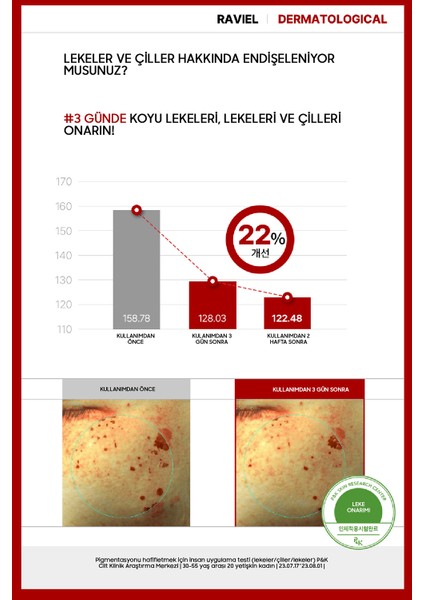 Koyu Lekeler Için Acerola Dark Spot Blemish Care Krem Set (2 Adet)