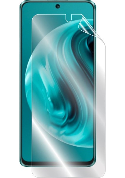 Huawei Nova 12I Ipg Hydrogel (Ince Tpu) Ekran Koruyucu