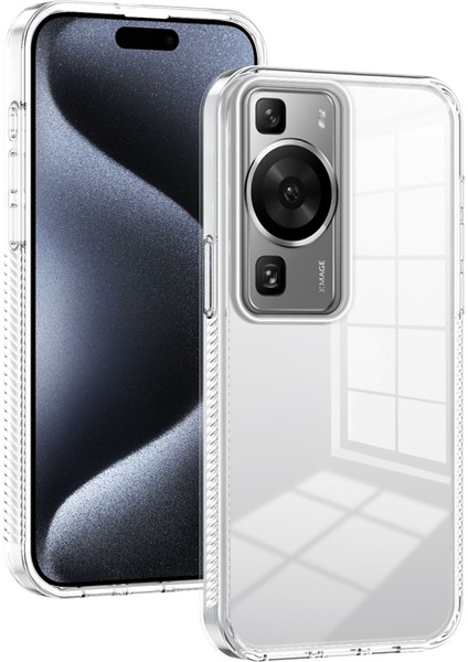 Huawei P60 Için Akrilik Hibrit Tpu Kılıf (Yurt Dışından)