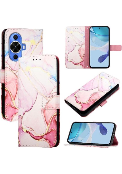 Huawei Nova 12S Telefon Kılıfı (Yurt Dışından)