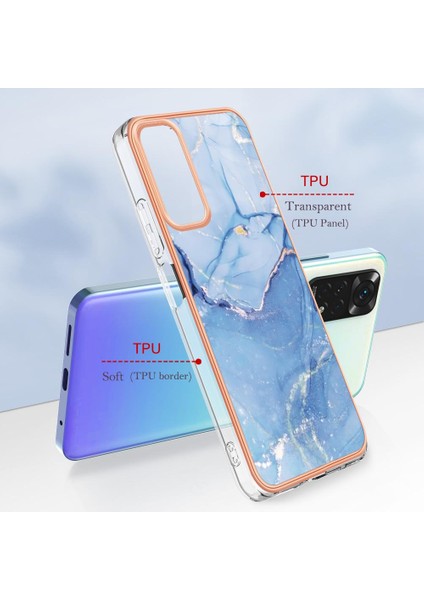 Xiaomi Redmi Not 11 4g Kılıf ile Uyumlu (Yurt Dışından)