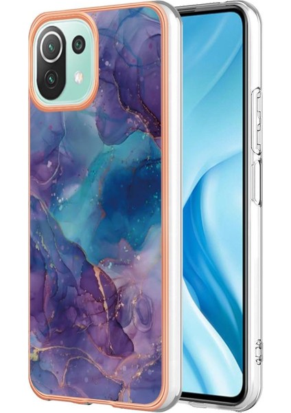 Xiaomi 11 Lite 5g Durumda ile Uyumlu (Yurt Dışından)