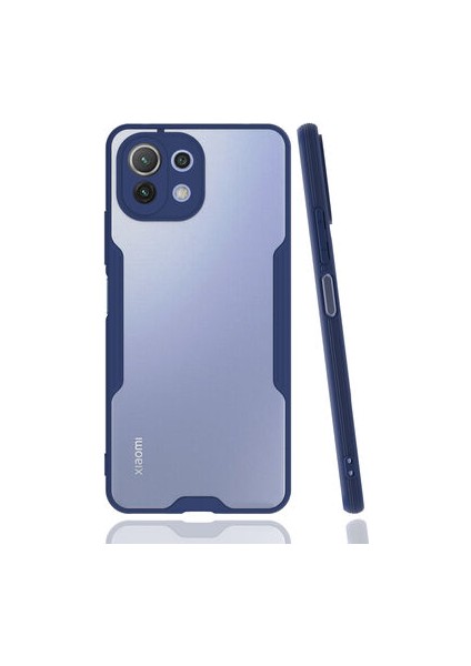 Xiaomi Mi 11 Lite Kamera Korumalı ve Şık Tasarımlı Parfe Premium Silikon Kılıf