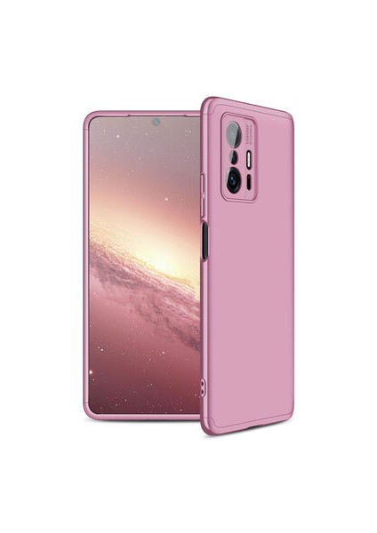 Xiaomi Mi 11T Pro 5g 3 Parçalı Tam Koruma Şık Astrea Premium Sert Kılıf