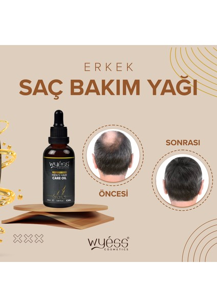 Wyess Erkekler Özel Saç Bakım Yağı Yeni Saç Teli Çıkaran E Vitaminli 30 Yağ 50 ml