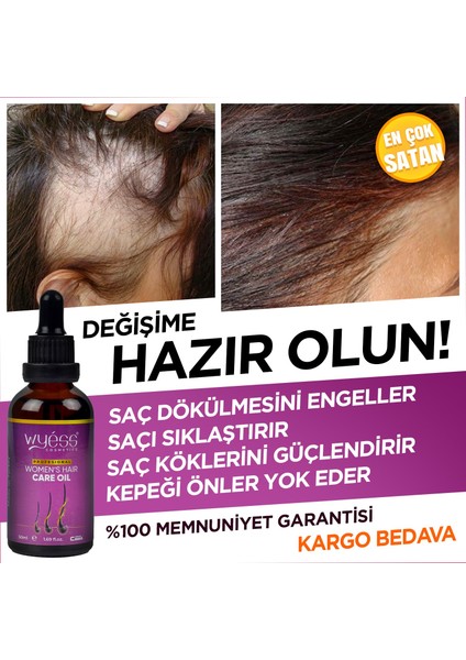 Wyess Kadınlara Özel Saç Bakım Yağı Yeni Saç Teli Çıkaran Kenevir Yağı 50 ml